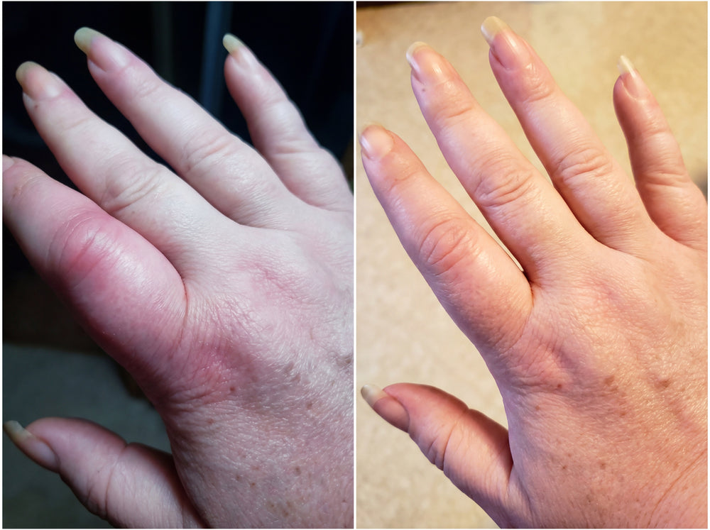 2. Reduce Hand Pain — Without Side Effects